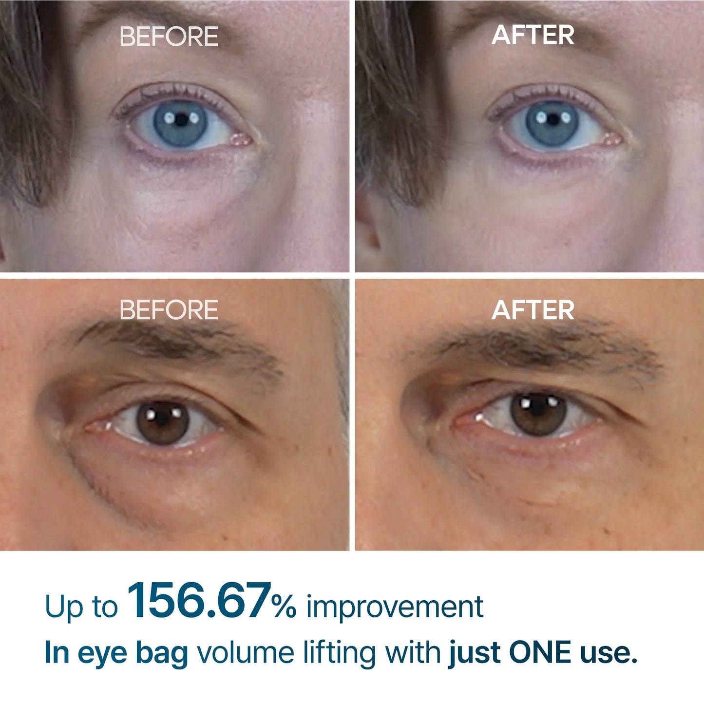 Dr. Melaxin Eye Revive Cream | Advanced Under-Eye Treatment